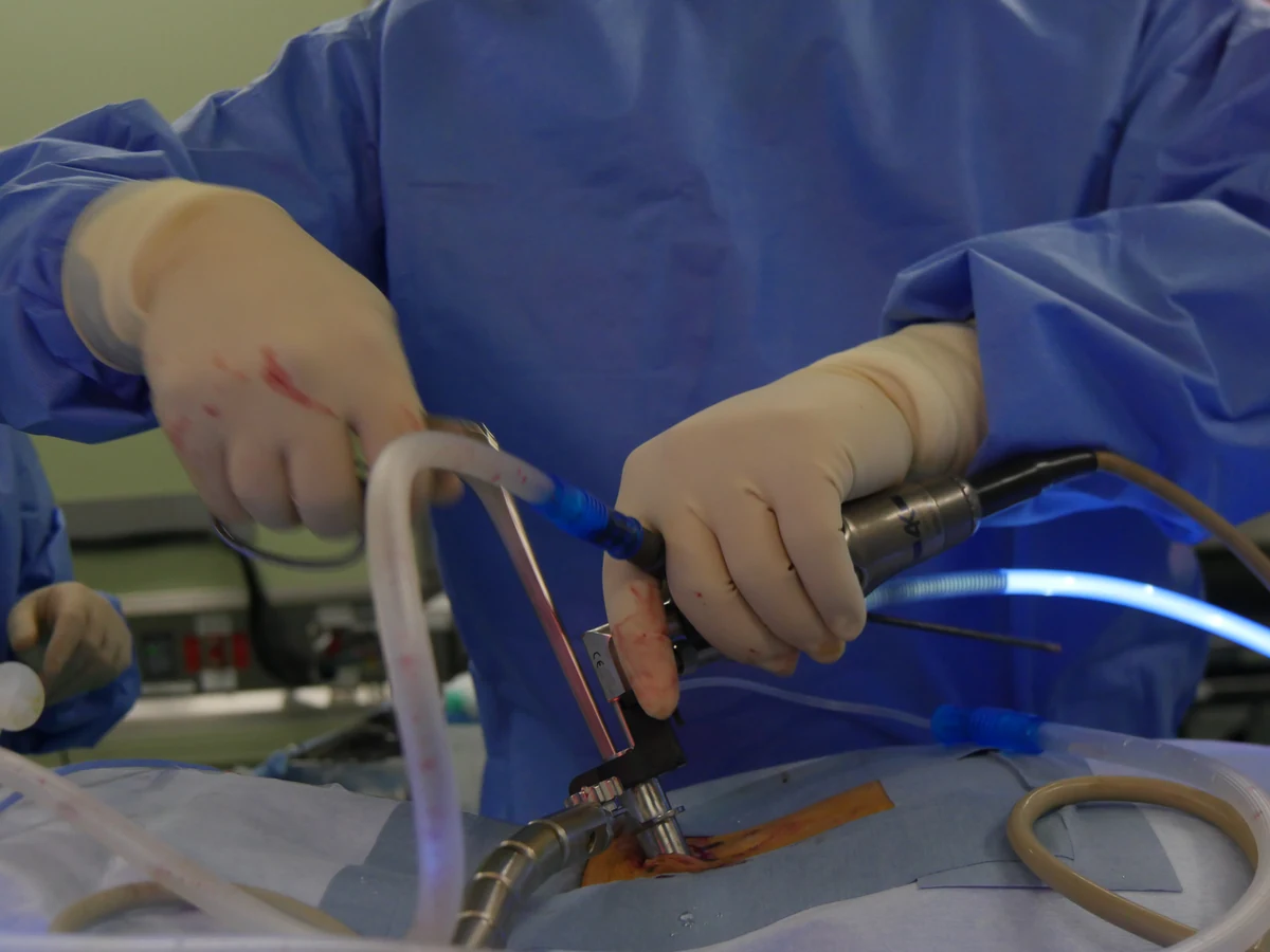 A surgeon's hands operating an endoscope and surgical instruments